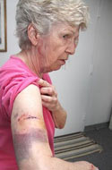Margaret Murphy pit bull attack