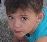 Pit bull attack victim - Colton Kline