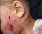 pit bull attacks boy spring valley