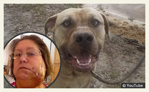 grandmother attacked by family pit bull during ice bucket challenge