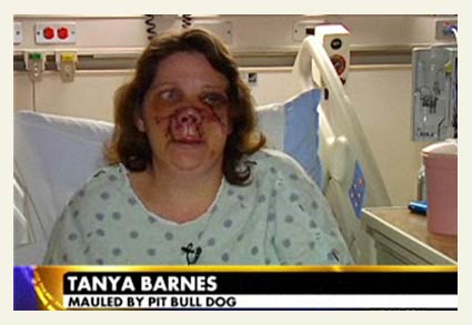 Tanya Barnes, pit bull attack